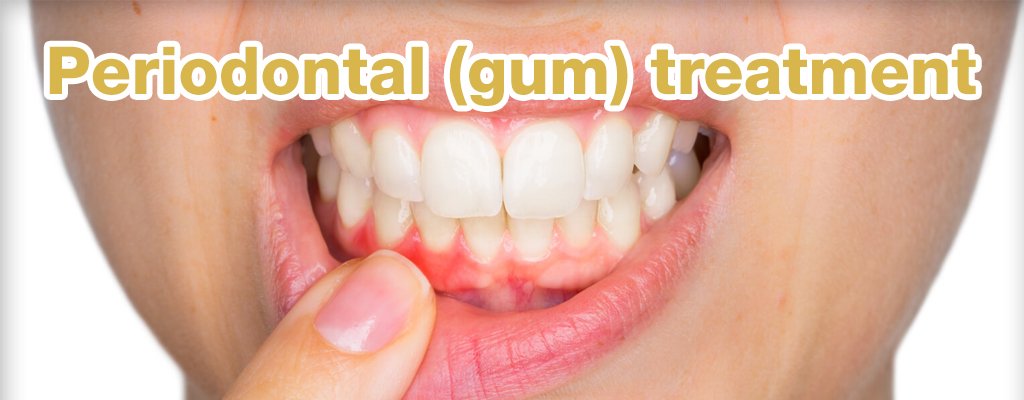 Periodontal (gum) treatment