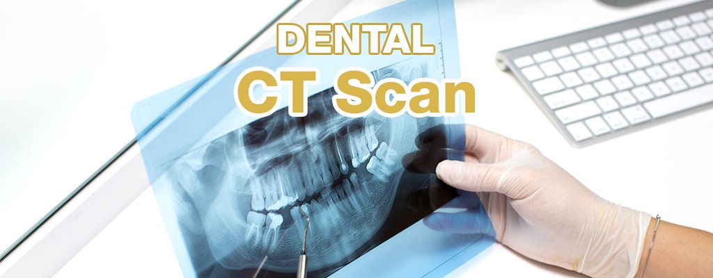 Dental CT Scan